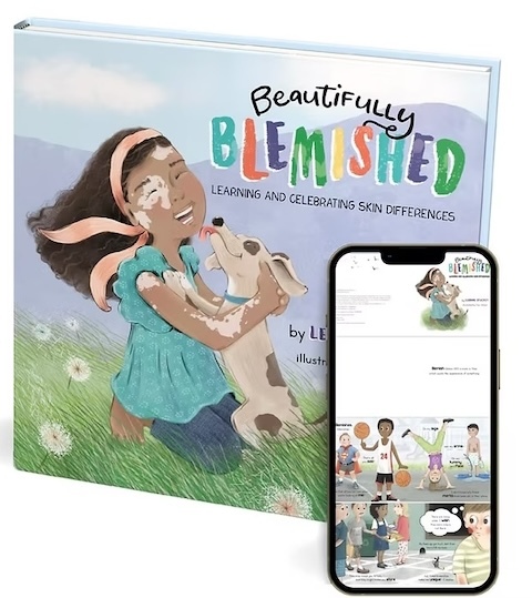 Beautifully Blemished cover